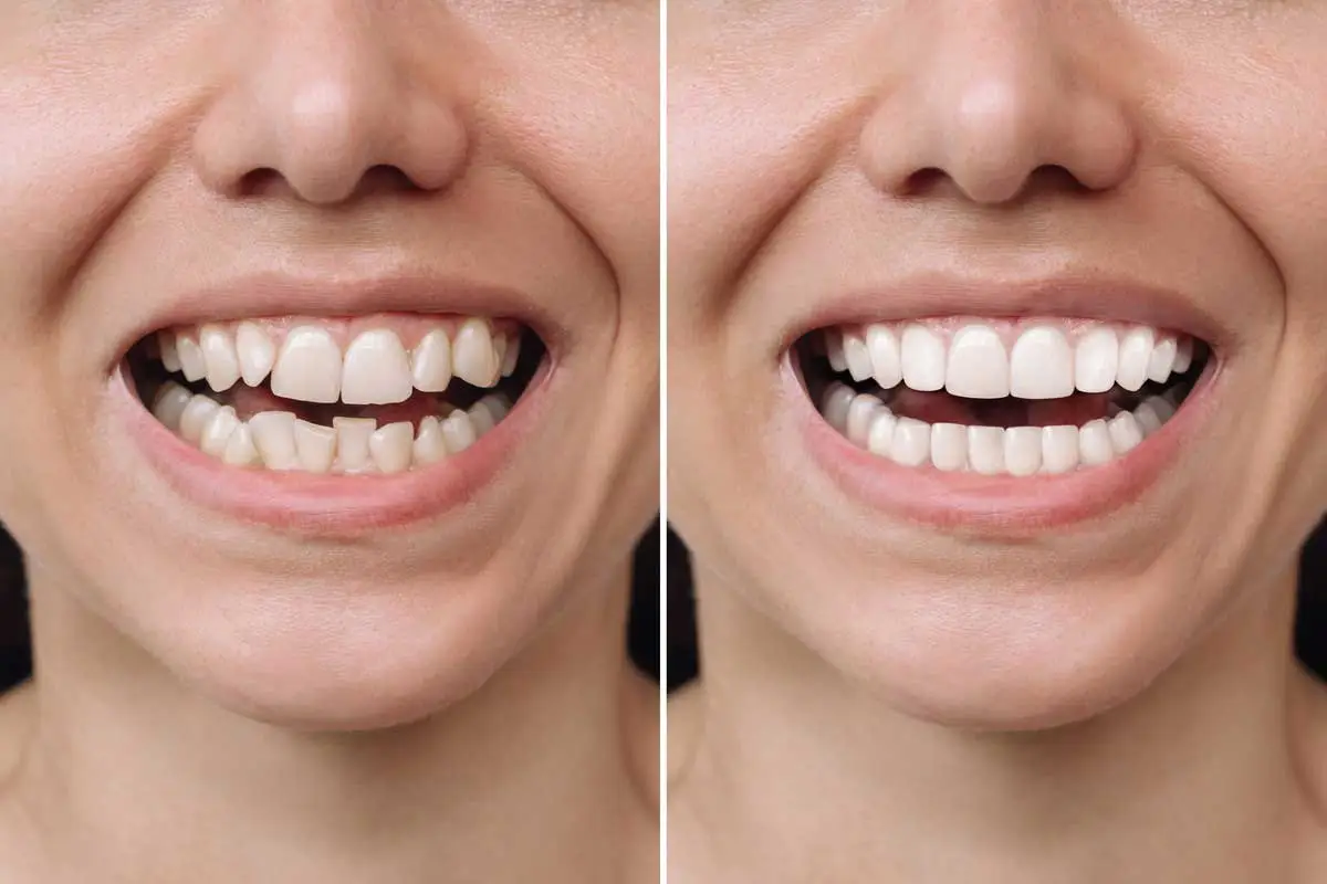 Before Best Dental